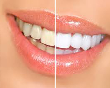 dentista coslada