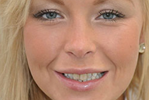 clinicas dentales en coslada 