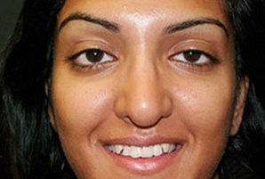clinicas dentales en coslada 