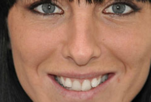 clinicas dentales en coslada 