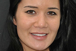 clinicas dentales en coslada