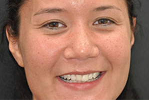 clinicas dentales en coslada 