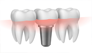 dentistas coslada