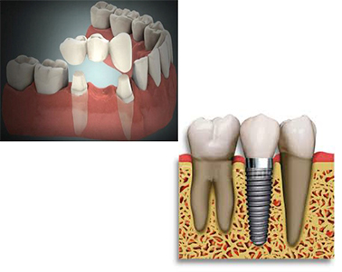 dentistas coslada